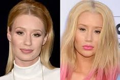 iggy azalea new nose! Fuzion Medical Aesthetic Boutique & David Goodkind MD. 203-871-3799 New Hairstyle, Medical Aesthetic, Face Photo, Cosmetic Surgery