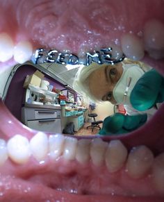 a dentist's office is reflected in the reflection of an open mouth with dental instruments