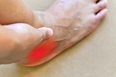 Ankle Injury, Health Heal, Sprained Ankle, Heel Pain, Foot Pain