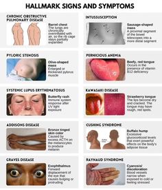 the signs and symbols of different types of skin