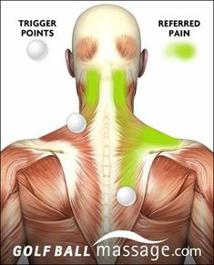 Massage Anatomy, Psoas Release, Referred Pain, Foot Reflexology, Neck Pain Relief, Neck And Shoulder Pain