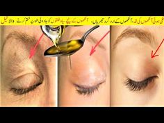 How To Treat Droopy Eyelids, Eyes Dark Circles Fine line and Naturally ( Amazing Result..100% Works) - YouTube Droopy Eyelids Drawing, Droopy Eyelids Remedy, Eye Makeup For Crepey Eyelids, Exercises For Droopy Eyelids, How To Fix Droopy Eyelids, Crepey Eyelids, How To Lift Eyelids Naturally, Best Eye Drops