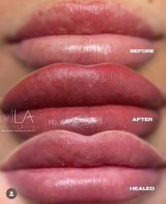 Have you ever wondered what Lip Blush is? In this blog post you can get all the details! Lip Blushing Tattoo Colors, Beauty Industry, Color Tattoo