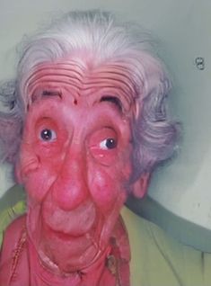 an old woman with white hair and pink eyes