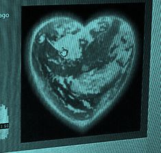 an image of a heart on a computer screen