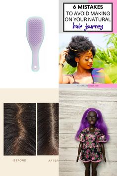 natural hair regrowth remedies Natural Hair Journey, Hair Journey, Natural Hair