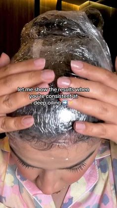 Bald Hair Growth, Extreme Hair Growth, Hair Style Vedio, Bald Patches, Hair Growth Cycle, Bald Spot, Regrow Hair, Keeping Healthy, Hair Regrowth