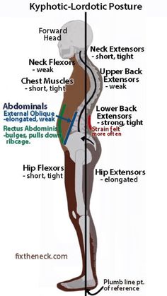 Forward Head Posture, Yoga Anatomy, Chest Muscles, Neck And Back Pain, Hip Flexor