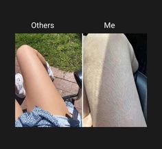 before and after photos of the same person's legs