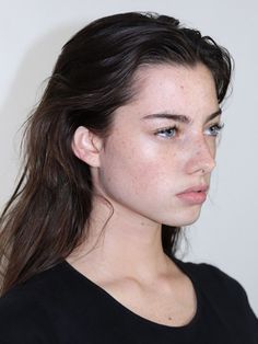 a young woman with freckles on her face