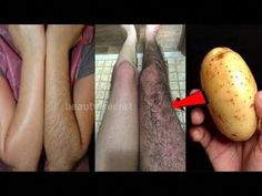 Stop Shaving, Pubic Hair Removal, Vellus Hair, Underarm Hair Removal, Shaving Tips, Body Hair Removal, Hair Help, Unwanted Hair Removal, Unwanted Hair