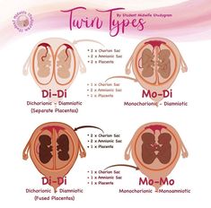 an image of different types of twins in the human body and their corresponding parts are labeled