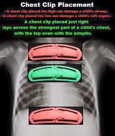 an ad for the chest clip placement, with three different colored clips on each side