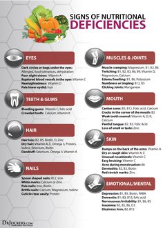 5 Body Signs of Nutritional Deficiencies - DrJockers.com Healing Diet, Health Challenges, Diet Program, Nutritional Deficiencies, Diet Keto, Health Facts, Vitamin A