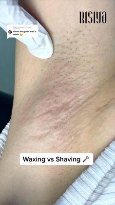 Waxing Vs Shaving, Gym Membership Card, Bleached Hair Repair, Laser & Ipl Hair Removal Devices, 12 Minute Workout, Tone Thighs, Painless Hair Removal, Diy Skin Care Recipes, Skin Care Recipes