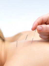 Acupuncture reduces hot flashes for breast cancer survivors in both frequency and intensity according to new research. Acupuncture Benefits, Acupuncture Clinic, Dry Needling, Alternative Therapies, Adrenal Fatigue, Holistic Medicine, Acupressure, Chiropractic, Alternative Medicine