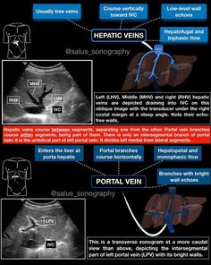 the different types of mris are shown in this diagram, including an x - ray and