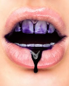 Whiten Teeth Fast, Tooth Repair, Whitening Teeth, Purple Dye