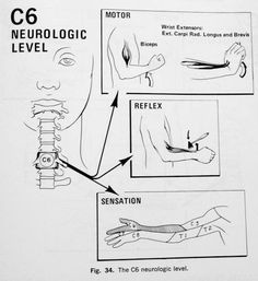 Punkty Spustowe, Control Center, Human Anatomy And Physiology, Massage Benefits, Chiropractic Care, Nerve Pain