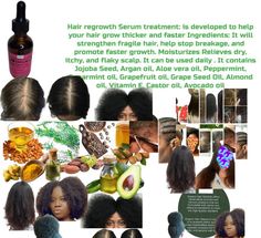 How To Use Apple Cider Vinegar For Hair Growth Oil For Scalp, Organic Conditioner, Hair Solution, Grease Hairstyles, Aloe Vera Oil, Soften Hair, Herbal Hair, Hair Treatments