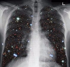 an image of the lungs with stars on them