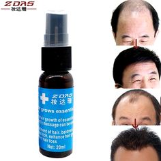 Hair Growth Essence Hair Loss Liquid dense hair care products treatment Original Andrea Hair fast growing essential oil serum 3 Dry Hair Repair, Hair Regrowth Remedies, Dense Hair, Hair Regrowth Women, Essential Oil Hair Growth, Essential Oil Beauty, Hair Regrowth Treatments, New Hair Growth, Free Teacher