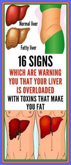 Detox Your Liver, Liver Detoxification, Liver Detox, Healthy Liver, Eating Organic, Natural Detox, The Liver, Natural Therapy, Body Detox