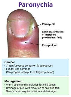 an image of the anatomy of a person's nail