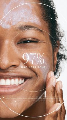 Prime Skin, Acne Help, Body Acne, Acne Breakout, Pore Cleansing, Effective Skin Care Products, Enlarged Pores, Clear Acne, Rodan And Fields