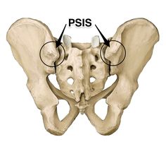 psis yoga anatomy Pelvic Tilt Exercise, Anterior Pelvic Tilt, Hip Problems, Bum Workout, Pelvic Tilt, Yoga Anatomy, Tight Hip Flexors, Human Body Anatomy