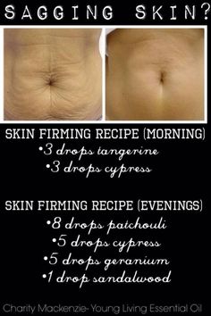 Sagging Skin Be Gone with this DIY recipe – Bath and Body Healing Essential Oils, Essential Oils Guide, Home Remedies For Acne, Essential Oils For Skin, Essential Oil Diffuser Blends, Young Living Oils