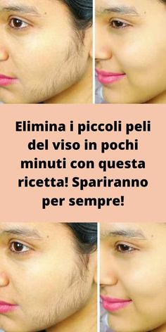 Elimina i piccoli peli del viso in pochi minuti con questa ricetta! Spariranno per sempre! Glow Up?, Acne, Health, Makeup, Quick Saves, Beauty, Make Up