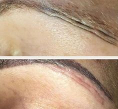 Viral photos highlight the risks of going to a REALLY bad eyebrow salon Eyebrow Images, Thrive Cosmetics, Viral Photos, Ombre Eyebrows, Bad Eyebrows, Eyebrow Stamp, Eyebrow Shaper, Eyebrow Hacks, How To Draw Eyebrows