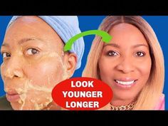 #Khichibeauty  #khichibeautytips50 LOOK 30 | GET CLEAR SKIN IN 7 DAYS, TIGHTEN FIRM, REMOVE DARK SPOTS, LOOK YEARS YOUNGER LONGERMy skin is looking its best ... Get Clear Skin, Face Tightening, Get Rid Of Warts, Tighter Skin, Skin Tissue, Remove Dark Spots