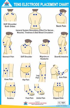 Forward Head Posture Exercises, Cupping Massage, Massage Therapy Techniques, Kinesiology Taping