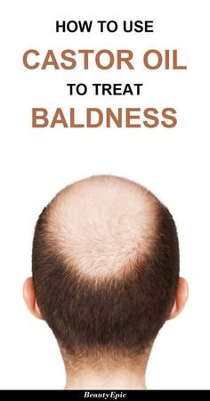 How to Treat Baldness with Castor Oil Baking Soda Shampoo Recipe, Hair Growth For Men, Castor Oil For Hair Growth, Homemade Shampoo, Castor Oil For Hair, Home Remedies For Hair, Baking Soda Shampoo, Hair Control, Hair Remedies