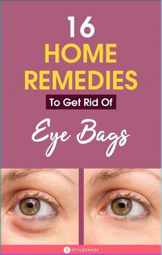 Top 16 Home Remedies To Get Rid Of Eye Bags: Tiredness is actually one of the most common causes of having under eye bags. Stress and water retention are the other common causes. Getting rid of puffy eyes is something that you can easily do at home. With these simple solutions, you can say goodbye to those unsightly eye bags. #Remedies #EyeBags #HomeRemedies #EyeCare Eyebags Remedy Under Eyes, Eyebags Remedy, Undereye Bags Remedy, Get Rid Of Eye Bags, Rid Of Eye Bags, Remove Eye Bags, Body Tattoo Design, Pop Art Makeup