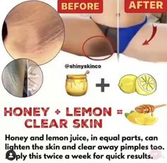 Latihan Kardio, Skin Care Face Mask, Smink Inspiration, Clear Skin Tips