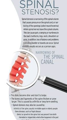 Carrie Ann Inaba, Psoas Release, Chronic Back Pain, Spinal Nerve, Back Pain Remedies, Spine Health, Nerve Pain Relief, Sciatic Nerve Pain, Sciatica Pain