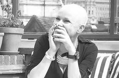 Gail Porter, Hair Growth Cycle, Male Pattern Baldness, Pattern Baldness, Extreme Hair, Bald Women