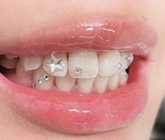 a woman's smile with braces and stars on it