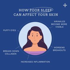 Why good sleep is important💤 #andnowtosleep #sleepmist #sleepspray #pillowspray #linenspray #aromatherapyskincare #anxietyrelief #stressmanagement #stressreliever #destress #stress #pillowmist #sleepproducts #nightlyroutine #lavenderessentialoils #health #wellbeing #selfcare #mindfulness #healthy #mentalhealth #pillows #flatlay #visualstyling #wellness #selfcarematters #anxiety #stressrelief #productphotography #mysha Sleep Is Important, Wake Up Refreshed, Wrinkled Skin, Sleep Well