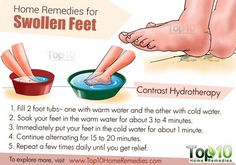 Swelling Remedies, Swollen Feet Remedies, Feet Remedies, Water Retention Remedies, Top 10 Home Remedies, Swollen Ankles, Back Pain Remedies, Swollen Legs, Fluid Retention