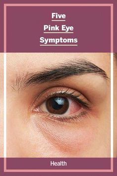 Learn about pink eye (conjunctivitis) symptoms, as well as some of the most common causes, treatments, and when to see a healthcare provider. Pink Eye Infection, Pink Eye Symptoms Signs, How To Get Rid Of Pink Eye Fast, Pink Eye Remedy, Pinkeye Remedies, Eye Problems, Eye Infections, Pink Eye