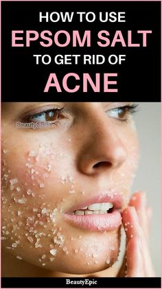 Is Epsom Salt Good For Acne? How To Use IT | Epsom salt for acne, How to treat acne, How to get rid of acne #Get_Rid_Of_Acne_Fast #Chest_Acne #Forehead_Acne #Get_Rid_Of_Acne Get Rid Of Acne Fast, Forehead Acne, Epson Salt, Get Rid Of Acne, Rid Of Acne, Home Remedies For Acne, Baking Soda Shampoo, Health Trends, Acne Remedies