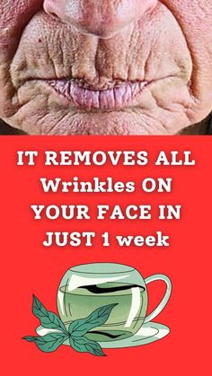 Apply this at home and remove deep face Wrinkles next week >>WATCH THIS SECRET<< Face Wrinkles Remedies, Wrinkles Remedies Face, Coconut Health, Wrinkle Free Skin, Skin Care Wrinkles, Face Wrinkles, Wrinkled Skin