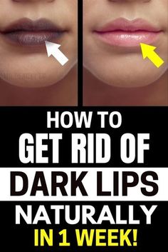 Lips of varying shades and colors are a natural occurrence, but hyper-pigmentation may cause cosmetic and health problems. Instead of using chemical treatments or pharmaceuticals, most people find that using natural and organic remedies is all that's needed to get rid of this discoloration for good. If your lips have become too dark, continue reading to discover how to naturally lighten them. Here are 4 Natural Remedies to Lighten Dark Lips at home!#beautytips#darklips#lipsremedy Diy Lip Care, Remedies For Ear Infections, Pigmentation Remedy, Antibiotics Natural, Remedies For Dark Lips, Lighten Dark Lips, Remedies For Sinus Infection, Remedies For Dry Mouth, Natural Remedies For Constipation