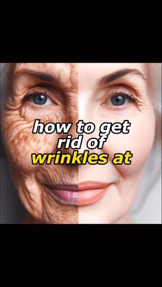 How To Remove Wrinkles On Face, How To Get Rid Of Wrinkles, Wrinkle Remedies Face, Remove Wrinkles From Face, Natural Wrinkle Reducer, Natural Wrinkle Remedies, Wrinkles Remedies, Wrinkles Remedies Face, Home Remedies For Wrinkles