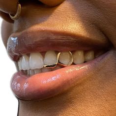 a close up of a woman's mouth and teeth with gold rings on it