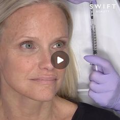 Swift Beauty on Instagram: "Treatment of the Lateral Canthal Lines with Mesomix of Toxin and Filler
.
.
.
.
.
.
#mesomix
#toxin
#filler
#crowsfeet
#lateralcanthallines
#drswift
#swiftbeauty
#masterclass
#beforeandafter
#injectables" Master Class